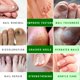 thumbnail image 4 of El gel de uñas de urea Scientific Solutions Global suaviza las uñas un 40%, 4 of 8
