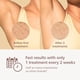 thumbnail image 2 of Depiladora Philips Lumea 8000 IPL BRI932/03, 2 of 3