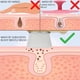 thumbnail image 3 of Cepillos de limpieza facial, cerdas suaves de crin, mango de bambú natural, limpieza profunda, masaje de poros, exfoliación, eliminación de puntos negros, exfoliante facial para el cuidado de la belle, 3 of 7