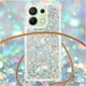 thumbnail image 5 of Funda FOXDOCK para Xiaomi Redmi Note 13 4G con Cuerda Ajustable, Brillo Líquido, Protección Antigolpes y Lente – Ideal para Regalo, 5 of 6