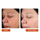 thumbnail image 5 of Suero facial BeautyStat Universal C 20% Vitamina C 30 ml, 5 of 9