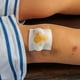 thumbnail image 3 of Pack 10 Gasas Esteril 90cmx45cm Insumo Medico Herida Lau, 3 of 3