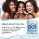 thumbnail image 3 of Crema curativa para cicatrices de acné Ayadara 60 ml para rostro y cuerpo, 3 of 7