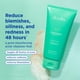 thumbnail image 2 of El limpiador Skinfix Acne+ BHA 150 ml reduce las imperfecciones y el exceso de grasa, 2 of 7
