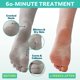 thumbnail image 2 of Mascarilla exfoliante para pies Patchology PoshPeel Pedi Cure, 1 par, 2 of 9