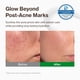 thumbnail image 2 of Hidratante Facial YUMU Cica Zinc Alivio para Imperfecciones 80 ml, 2 of 9