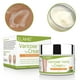 thumbnail image 2 of Crema para varices OTBK Crema para piernas para aliviar las varices, 2 of 3