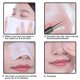 thumbnail image 2 of Pinzas Profesionales de Acero Inoxidable MUZE para Eliminación de Milia Facial, 2 of 8