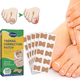 thumbnail image 1 of Pack 50 Parches Uñas Encarnadas Corrector De Crecimiento, 1 of 6