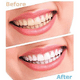 thumbnail image 2 of Cepillo Luma Smile, 2 of 4