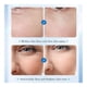 thumbnail image 5 of 15 Ampollas Dermapen   Serum Facial  Acido Hialuronico, 5 of 5