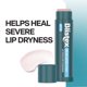 thumbnail image 2 of Bálsamo labial Blistex Medication, 4,4 ml, 3 unidades, previene la sequedad SPF15, 2 of 5