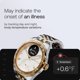 thumbnail image 5 of Smartwatch Withings Scanwatch Nova Brilliant SPO2 Temperatura, 5 of 7