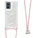 thumbnail image 3 of Funda FOXDOCK para Motorola Edge 2024 5G con Cuerda Ajustable, Brillo Líquido, Protección Antigolpes y Lente – Ideal para Regalo, 3 of 6