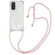 thumbnail image 1 of Funda FOXDOCK para Xiaomi Redmi Note 11/11s 4G con Cuerda Ajustable, Brillo Líquido, Protección Antigolpes y Lente – Ideal para Regalo, 1 of 6