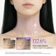 thumbnail image 3 of Mascarilla de cuello LOLOSKINNY Colágeno 30 unidades K-Beauty, 3 of 8