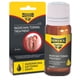 thumbnail image 1 of Kit de tratamiento para uñas encarnadas URIEL UPGRADE de 11 ml, 1 of 6