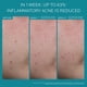 thumbnail image 5 of Tratamiento para el acné La Roche-Posay Effaclar BPO 5.5% 20 ml, 5 of 8