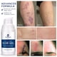 thumbnail image 4 of Crema en gel para cicatrices Murasaki Beauty, 30 g, 100% silicona para cicatrices, 4 of 6