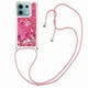 thumbnail image 3 of Funda FOXDOCK para Xiaomi Redmi Note 13 5G con Cuerda Ajustable, Brillo Líquido, Protección Antigolpes y Lente – Ideal para Regalo, 3 of 6