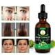 thumbnail image 3 of Aceite de ricino NIFEISHI negro jamaicano, 100% puro y natural, 60 ml, 3 of 3