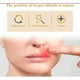 thumbnail image 2 of Parches Para El Herpes Labial Parches De Miel E Hidrocoloide, 2 of 3