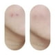 thumbnail image 4 of Catch Me Patch | Parches Antiacné que Absorben Impurezas, 4 of 4