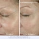 thumbnail image 3 of Set de crema hidratante facial y crema para ojos Obagi ELASTIDERM 50 ml, 3 of 9