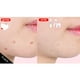 thumbnail image 3 of Crema Calmante E Hidratante Coreana Especial Para Pieles Con Acné - Ac Fighting, 3 of 3