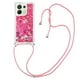 thumbnail image 3 of Funda FOXDOCK para Xiaomi Redmi Note 13 4G con Cuerda Ajustable, Brillo Líquido, Protección Antigolpes y Lente – Ideal para Regalo, 3 of 6