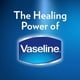 thumbnail image 5 of Vaseline Lip Therapy Labios Rosados con Rosa y Almendra 20 g, 5 of 5