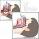 thumbnail image 3 of Set 6 Dispositivo Antirronquido 2 en 1 Nasal Purificador Lau, 3 of 3