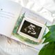 thumbnail image 4 of Libro de visitas para baby shower Lemon Sherbet, género neutro, con bolígrafo, 4 of 6