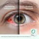 thumbnail image 3 of Mascarilla refrescante para ojos CorneaCare Rescue Hydrogel, 12 unidades, 3 of 8