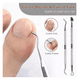 thumbnail image 3 of Set De Pedicure Removedor De Callos Removedor Cutícula Uñas, 3 of 7