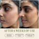 thumbnail image 4 of Exfoliante facial Mudita Earth Microdermabrasion para piel con acné, 4 of 9