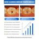 thumbnail image 2 of Pasta de dientes CAREDO Cavity Reversal Hidroxiapatita 100g, 2 of 3