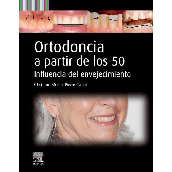 Ortodoncia a partir de los 50