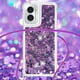 thumbnail image 5 of Funda FOXDOCK para Motorola Moto G Play 4G 2024 con Cuerda Ajustable, Brillo Líquido, Protección Antigolpes y Lente – Ideal para Regalo, 5 of 6