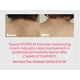 thumbnail image 2 of Crema hidratante ATOPALM Intensive para pieles secas y sensibles, 2 of 5