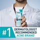 thumbnail image 3 of Cerave Crema limpiadora espumosa para el acné | Limpiador suave para rostro y cuerpo con peróxido de benzoilo y ácido hialurónico 10%, 150ml, 3 of 11