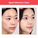 thumbnail image 2 of Crema TOSOWOONG Ovalicin Skin Clear con niacinamida 50 g, 2 of 7