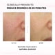 thumbnail image 2 of Crema facial Physiogel Calming Relief Enrojecimiento 30 ml, 2 of 6