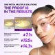 thumbnail image 3 of Parche para ojos ANUA Retinol Berry - 60 unidades, 3 of 9