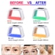 thumbnail image 1 of 7-in-1 LED Face Mask Equipment: Rejuvenate Your Skin with this At-Home Facial Beauty Machine!, 1 of 4