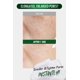 thumbnail image 3 of [Lavado facial] Mousse exfoliante DERMALOGY by NEOGENLAB Pore Zero, 100 ml, 3 of 8