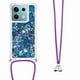 thumbnail image 1 of Funda FOXDOCK para Xiaomi Redmi Note 13 5G con Cuerda Ajustable, Brillo Líquido, Protección Antigolpes y Lente – Ideal para Regalo, 1 of 6