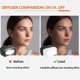 thumbnail image 3 of Difusor de Flash MOORDIEL IT30 Pro Iluminación Suave 2 Unidades, 3 of 4