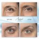 thumbnail image 3 of Gel para ojos hinchados Aqua Mineral – Resultados instantáneos 30 ml con té verde, 3 of 8