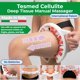 thumbnail image 2 of TESMED Cellulite Manual Massager Roller for Thighs and Buttocks, 2 of 3